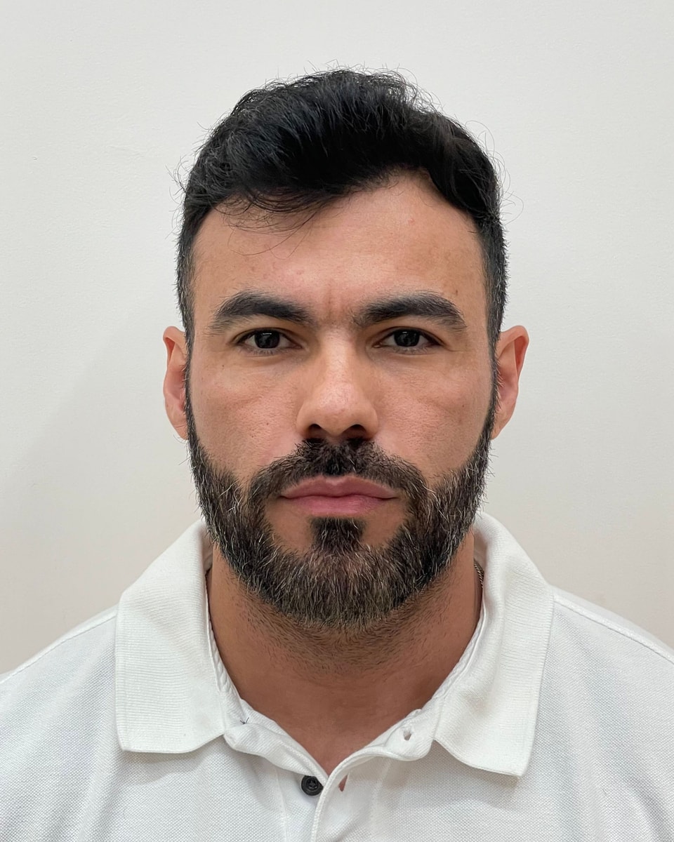 Rostro de un paciente de frente, antes del tratamiento