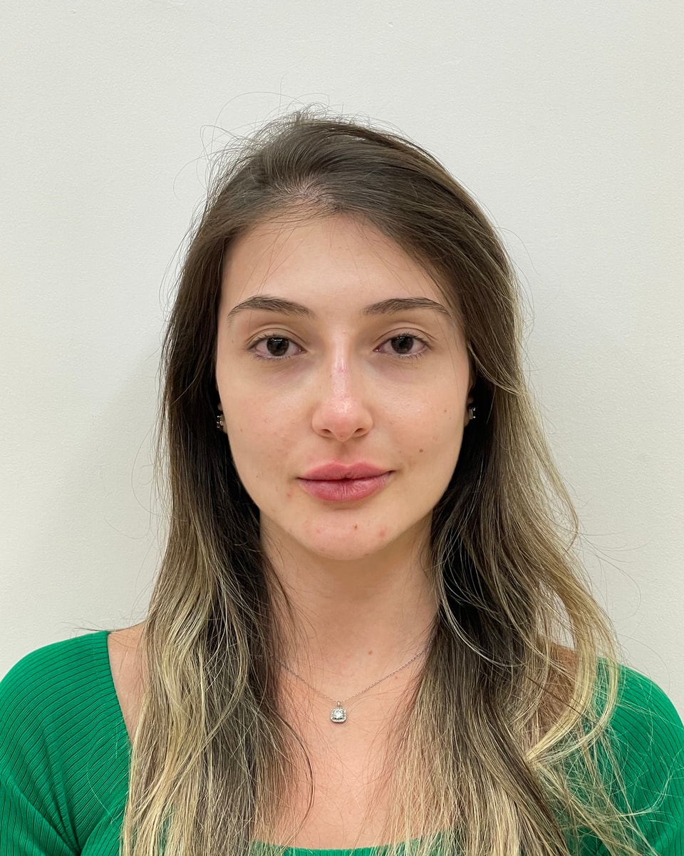 Rostro de una paciente de frente, después del tratamiento