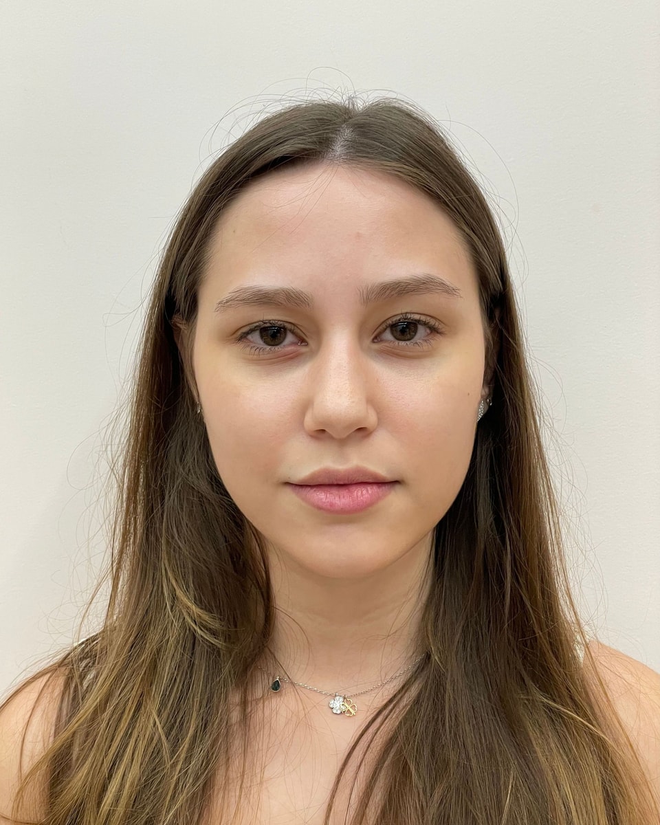 Rostro de una paciente de frente, antes del tratamiento